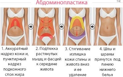 Как выполняется операция?