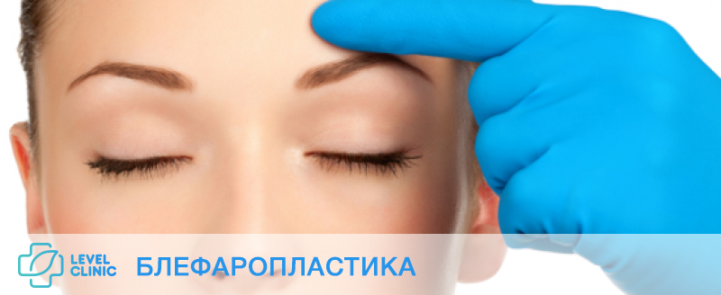 блефаропластика