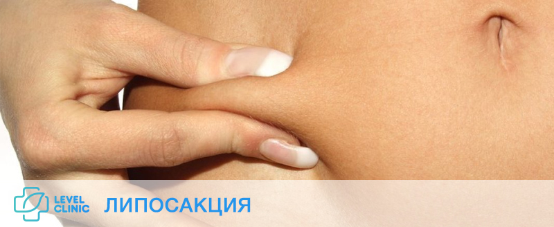 липосакция