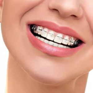 Эстетическая терапия.Ортопедия